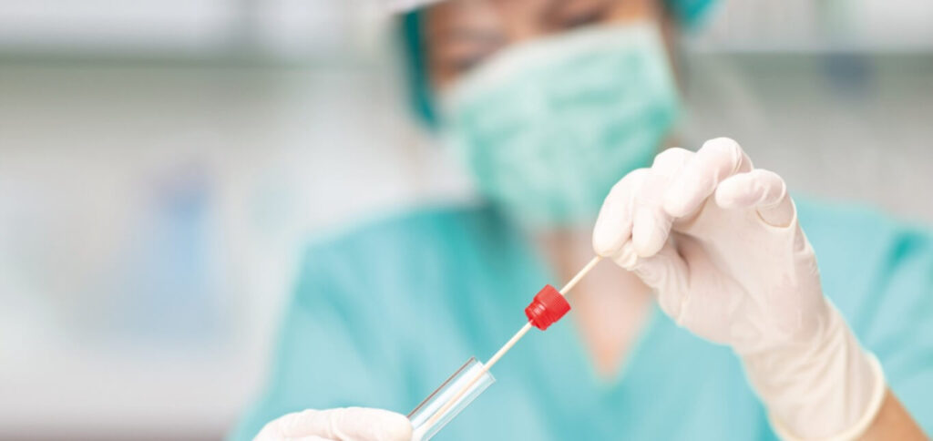 Basterà il test rapido per certificare l’infezione da Covid