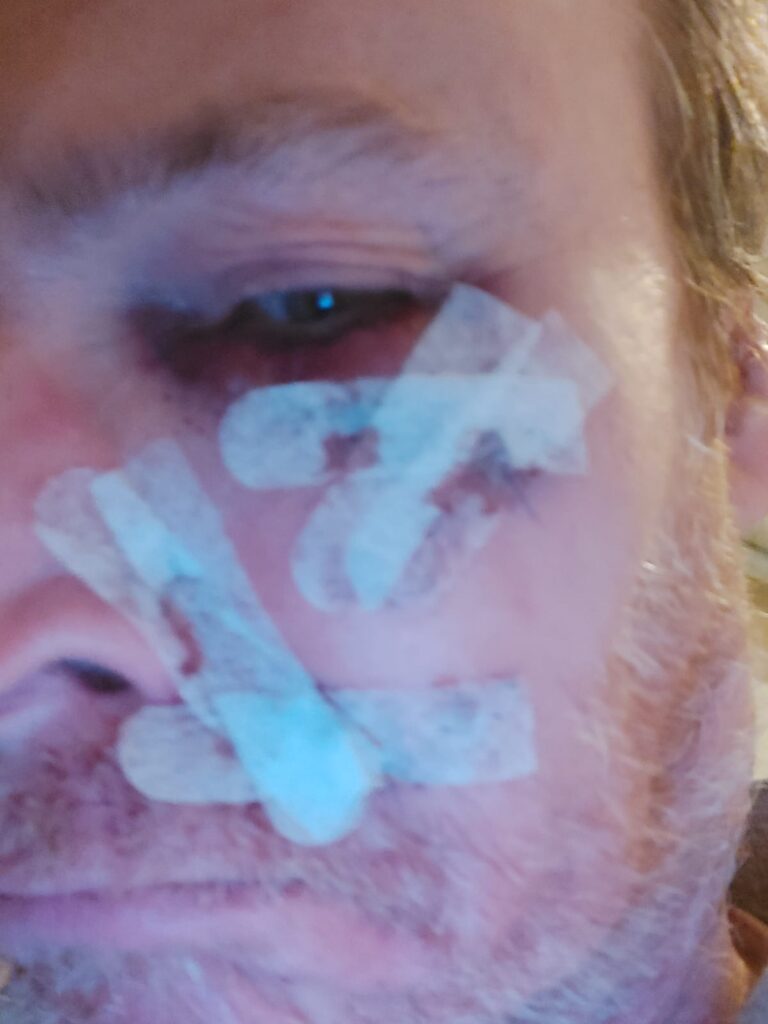 Tassista accoltellato e rapinato a Bologna