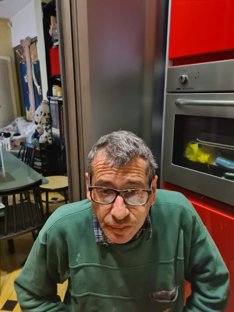 Muore dopo 18 giorni di coma: aperto un fascicolo