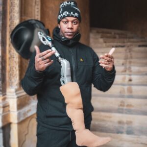 Da IOR e Ant nuova protesi per il rapper Bubu