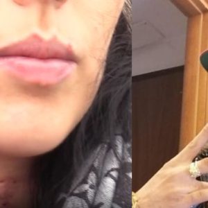 Accoltellò l’ex compagna in via Rialto, definitiva la condanna a 15 anni per Mehdi Fadl