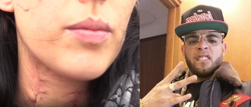 Accoltellò l’ex compagna in via Rialto, definitiva la condanna a 15 anni per Mehdi Fadl