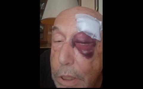 Parapiglia residenti-collettivo in Piazza Verdi, pugno in faccia a Folegatti