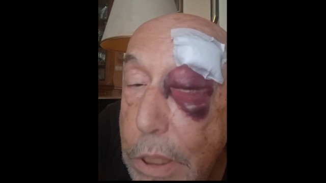 Parapiglia residenti-collettivo in Piazza Verdi, pugno in faccia a Folegatti