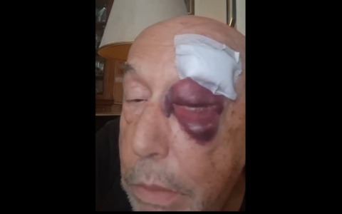 Pugno in faccia a Folegatti, tre ‘Dacur’ per attivisti del Cua